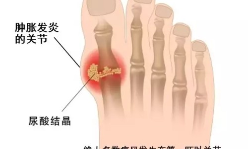 香米好吃还是大米好吃-大米与香米的区别专区_香米好吃还是大米好吃专区_大米和香米的营养有什么区别网